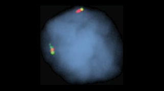 vysis-lsi-ccnd1-break-apart-rearrangement-hybridization-normal