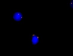 vysis-lsi-etv6-hybridization-normal