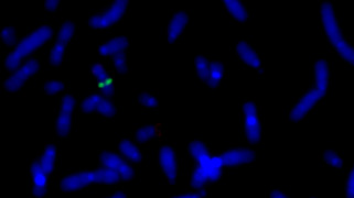 vysis-lsi-mapt-spectrumgreen-hybridization-normal.