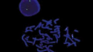 vysis-smith-magenis-region-probe-lsi-sms-hybridization-normal