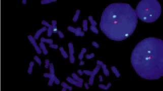 vysis-lsi-eln-hybridization-normal