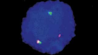 vysis-lsi-bcr-abl-dual-color-single-fusion-translocation-hybridization-normal-copy