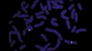 vysis-lsi-sts-spectrumorange-probe-hybridization-normal